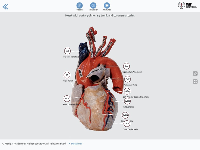 Screenshot of Museum of Anatomy & Pathology, KMC Manipal
